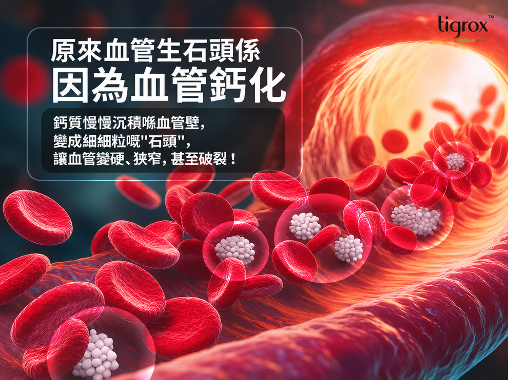 HOMEGA 血管鈣化介紹海報