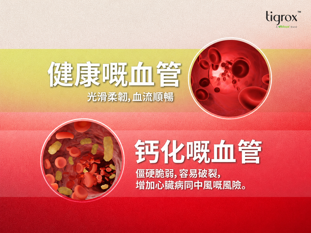 HOMEGA 血管比較海報